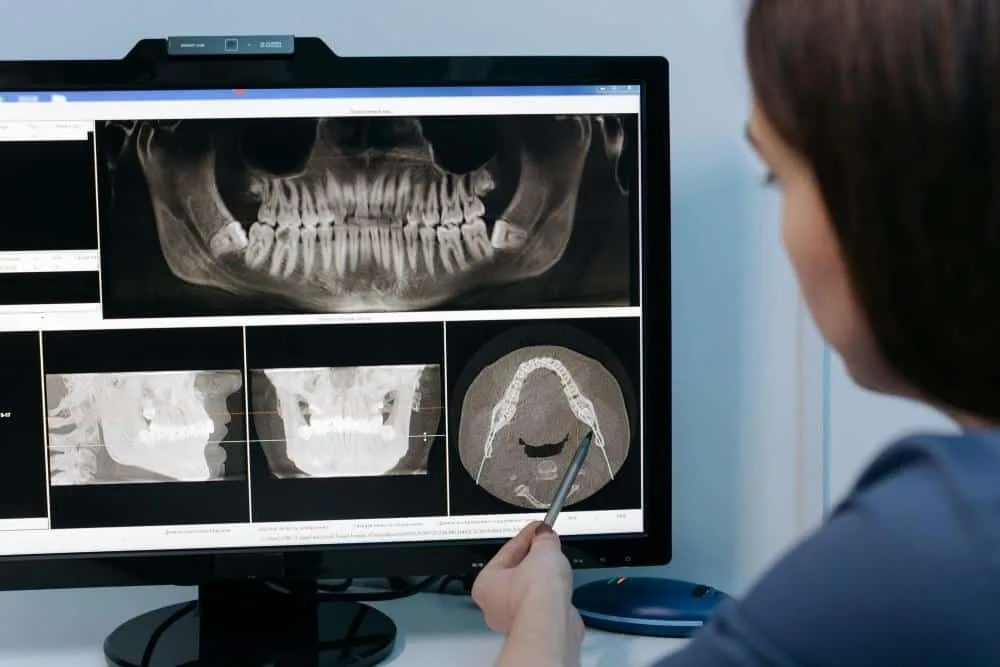 Dentist examining dental X-ray scans on a computer screen